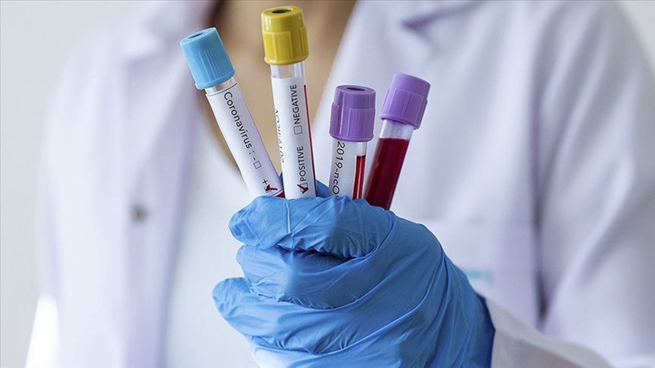 AstraZeneca: Aşı için ek testler yapılacak