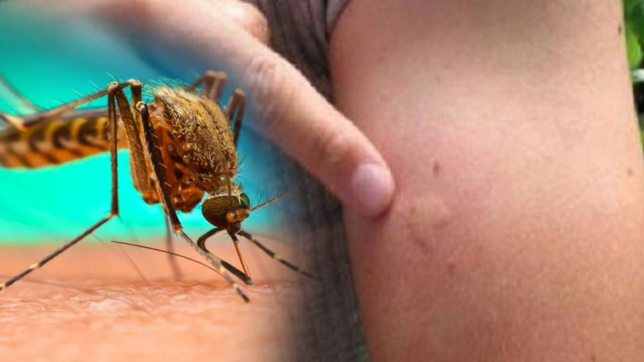 Batı Nil virüsü belirtileri nedir? Türkiye’nin yeni kabusu! Batı Nil virüsü nasıl bulaşır?