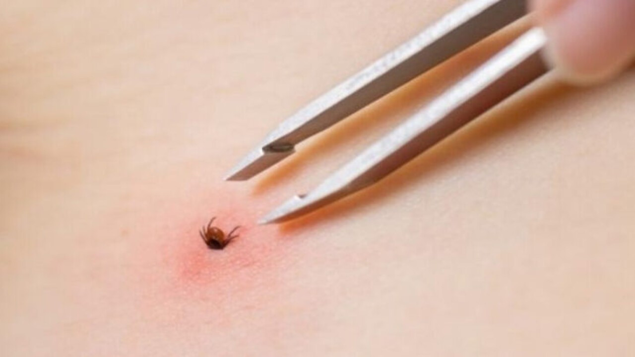 KKKA can almaya devam ediyor: Sivas’ta 30 yaşındaki Uğur Uymaz yaşamını yitirdi