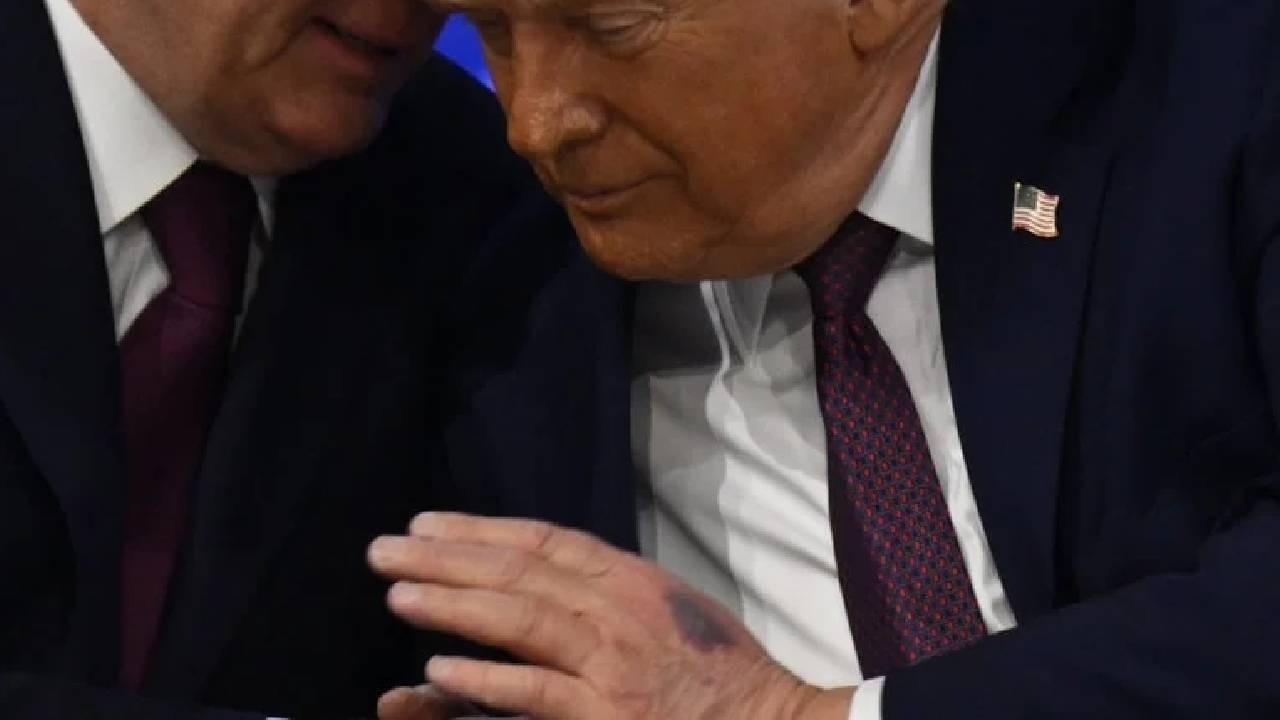 Trump, elindeki morluğun nedenini açıkladı