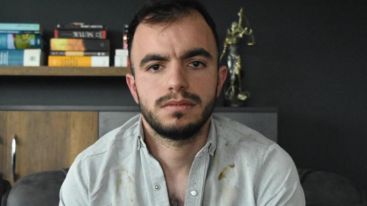 10 yıl önce başına metal parça saplanan işçi, 17 milyon 9 bin TL tazminat kazandı