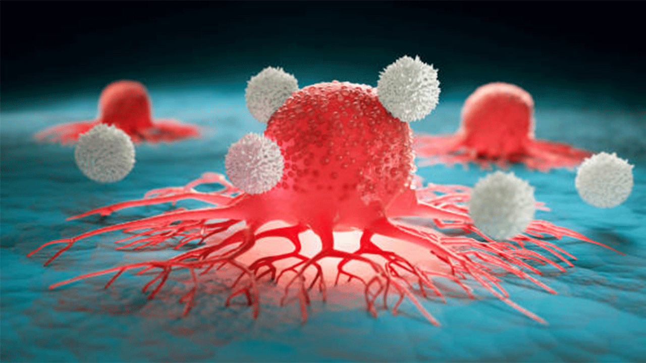 Üçlü kombinasyon tedavisi pankreas kanserine umut oldu