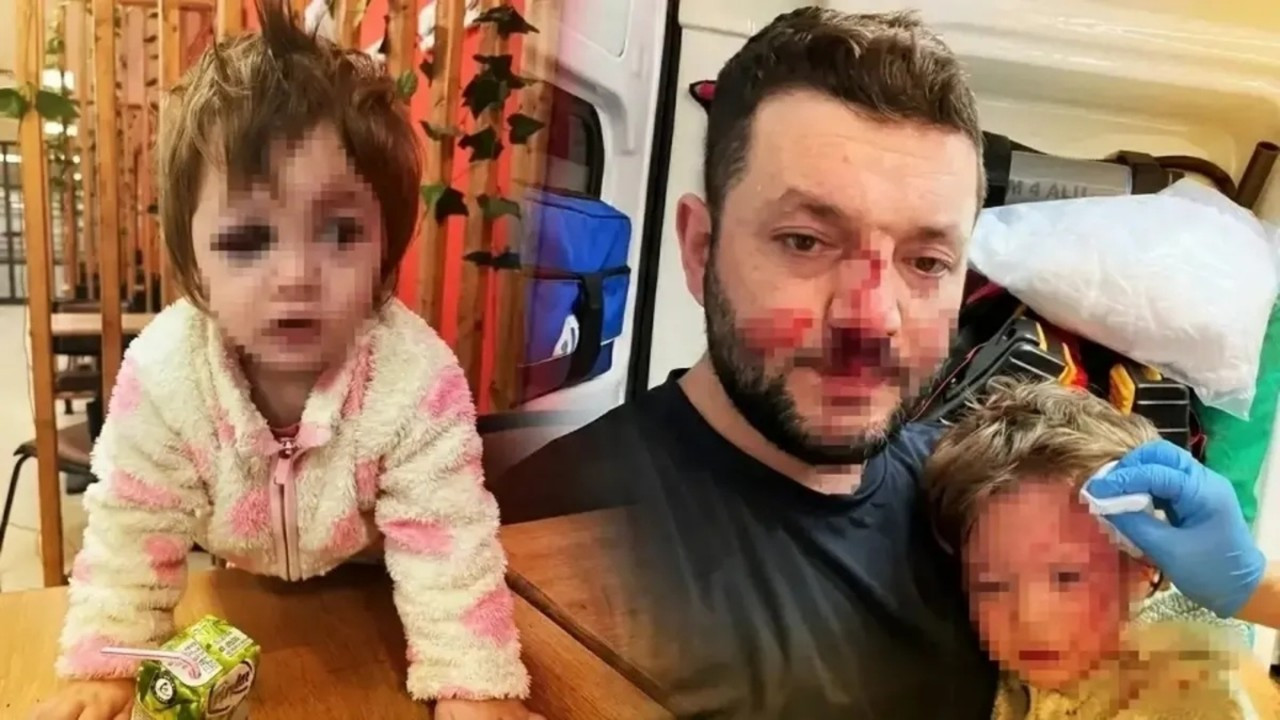 Baba ve kızı darp edilmişti! İçişleri Bakanlığı müfettiş görevlendirdi