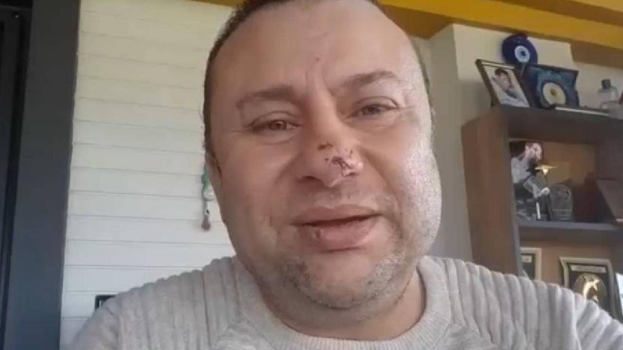 Pitbull saldırısına uğrayan Onur Akay yaşadığı dehşeti anlattı: 'Ölümden döndüm'