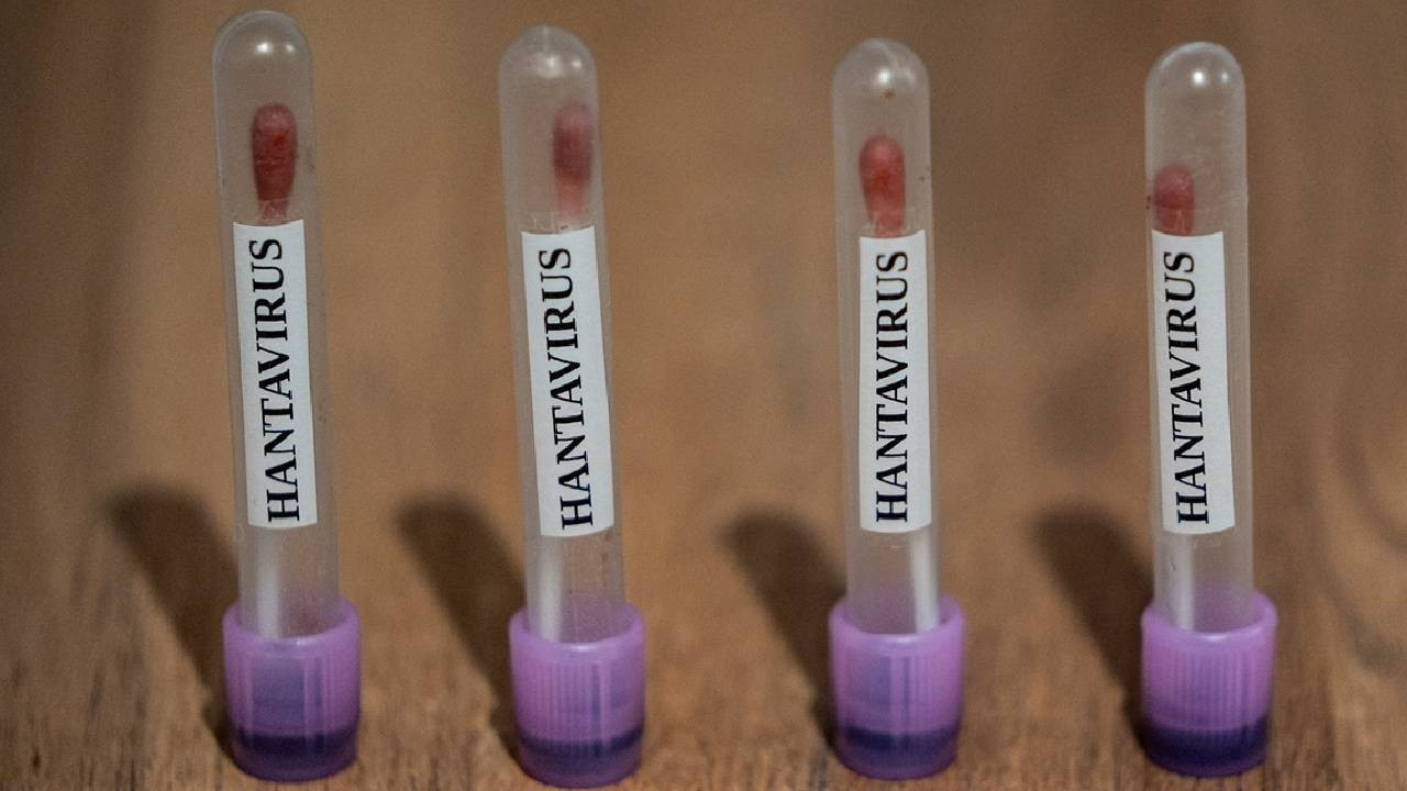 İngiltere: 3 Britanyalı, hantavirüse yakalandı