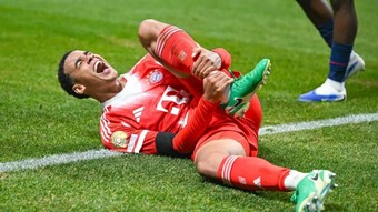 Sol ayak bileği kırılan Bayern Münihli futbolcu Jamal Musiala'nın sahalardan uzak kalacağı süre belli oldu