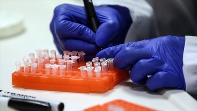 COVID-19'un kökeni için 'kapsamlı araştırma' çağrısı