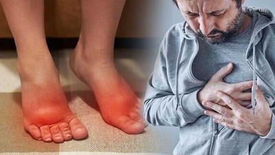 Ayaklarda bu belirti kalp riskinin habercisi olabilir: Bir şey olmaz deyip geçmeyin- Uzmanlar uyardı
