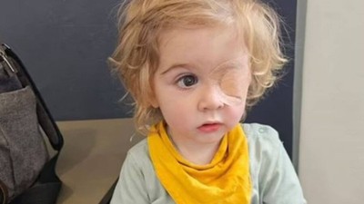 İki yaşındaki çocuk bir yakının öpücüğü yüzünden kör oldu