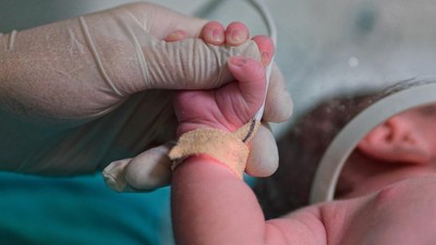 Özel tıp merkezleri hakkında yeni karar: Planlı sezaryene izin verilmeyecek