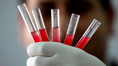 Bu kan grubundaysanız dikkat: Risk 16 kat daha yüksek! Gençler de yaşlılar da bu tehlikenin eşiğinde