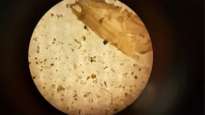 Araştırma: İnsanlar, günde on binlerce mikroplastik parçacığı soluyor olabilir