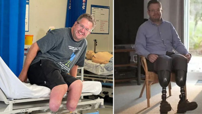 Cerrah bacaklarını kesip sigortayı 27 milyon TL dolandırdı!