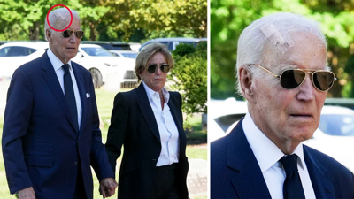 Eski ABD Başkanı Joe Biden ameliyat oldu