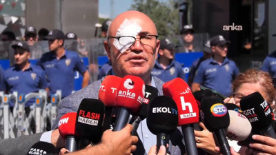 CHP'li Mahmut Tanal: G&ouml;zl&uuml;k olmamış olsaydı g&ouml;z kaybım kesindi