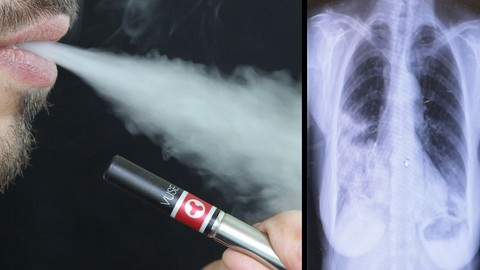 3 yıl elektronik sigara kullandı hayatının şokunu yaşadı! “Patlamış Mısır” tanısı konuldu