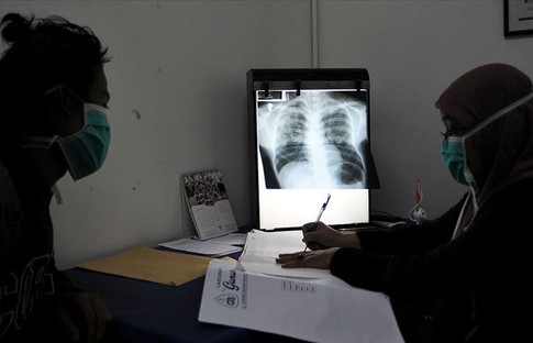 DSÖ: COVID-19 tüberküloz ölümlerini ilk defa artırdı