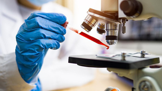 Yaşlanmak tarih olabilir! Yeni ilaç karışımı erkek farelerin ömrünü yüzde 73 uzattı