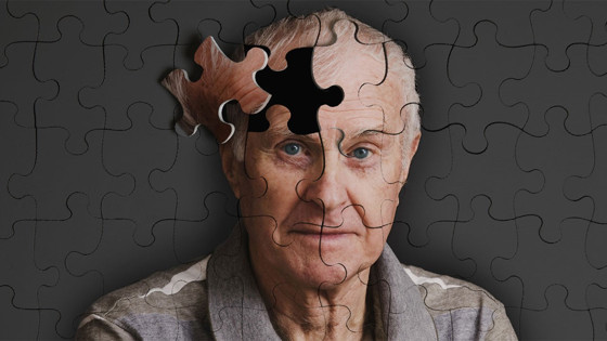 Bilim dünyasından sevindiren keşif: Alzheimer'ın nedeni bulundu