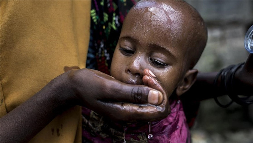 Sudan'da kolera salgını vaka sayısı artıyor! Yaşamını yitirenlerin sayısı 672'ye çıktı - Resim : 3