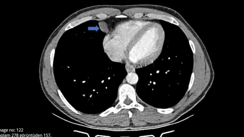 Öksürük ve hapşırık krizine girdi, hastanede çıkan sonucu görünce hayatının şokunu yaşadı - Resim : 3