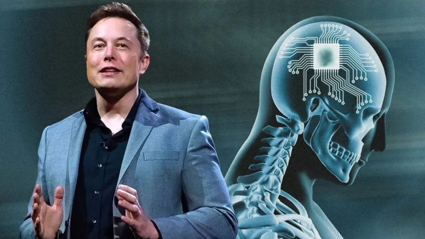 Kanada beyin çipi denemesi için Elon Musk’ın Neuralink şirketine onay verdi - Resim : 2