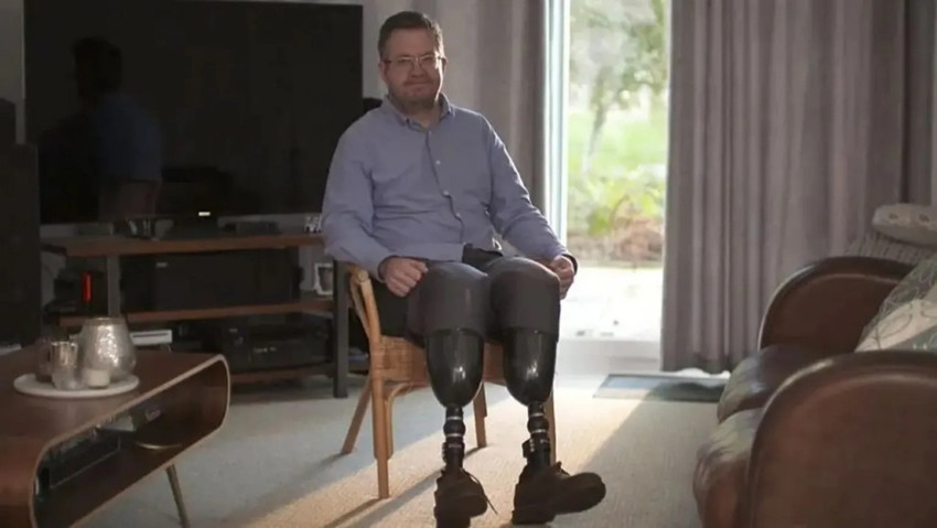 Cerrah bacaklarını kesip sigortayı 27 milyon TL dolandırdı! - Resim : 2