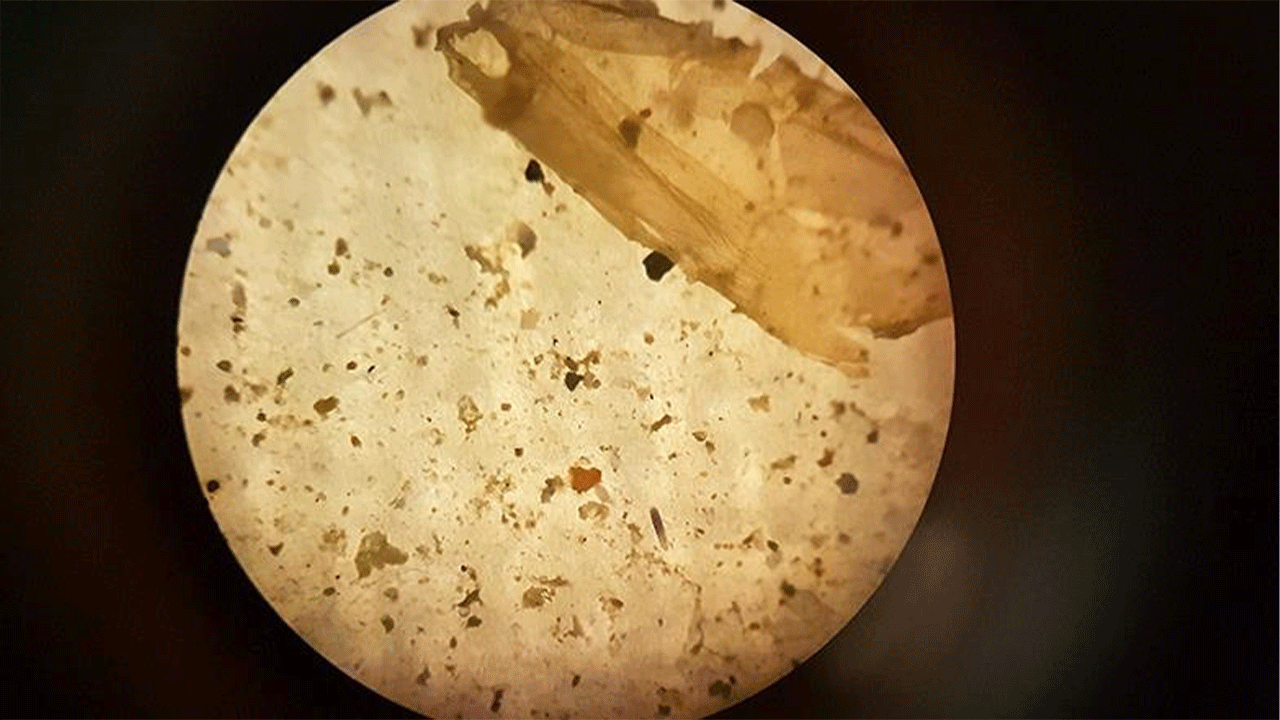 Araştırma: İnsanlar, günde on binlerce mikroplastik parçacığı soluyor olabilir