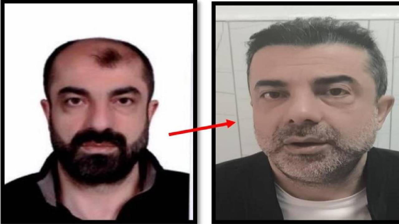 Ameliyat ile yüzünü değiştiren firari cinayet zanlısı 7 yıl sonra Türkiye'ye döndü, yakalandı