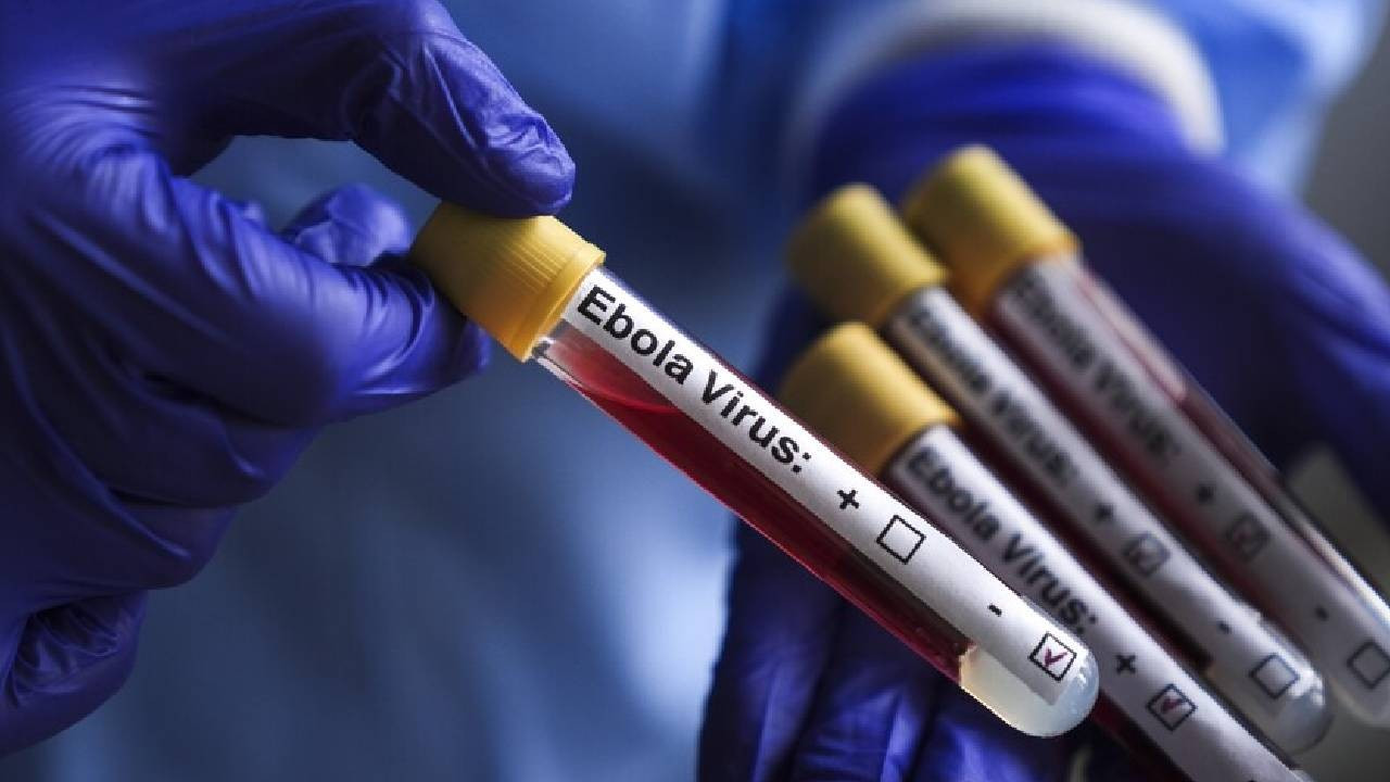 KKTC'den Ebola virüsüne karşı yeni tedbirler